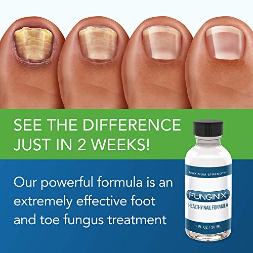Toenail Fungus Treatment Antifungal Liquid Solution (1 Bottle) J597700